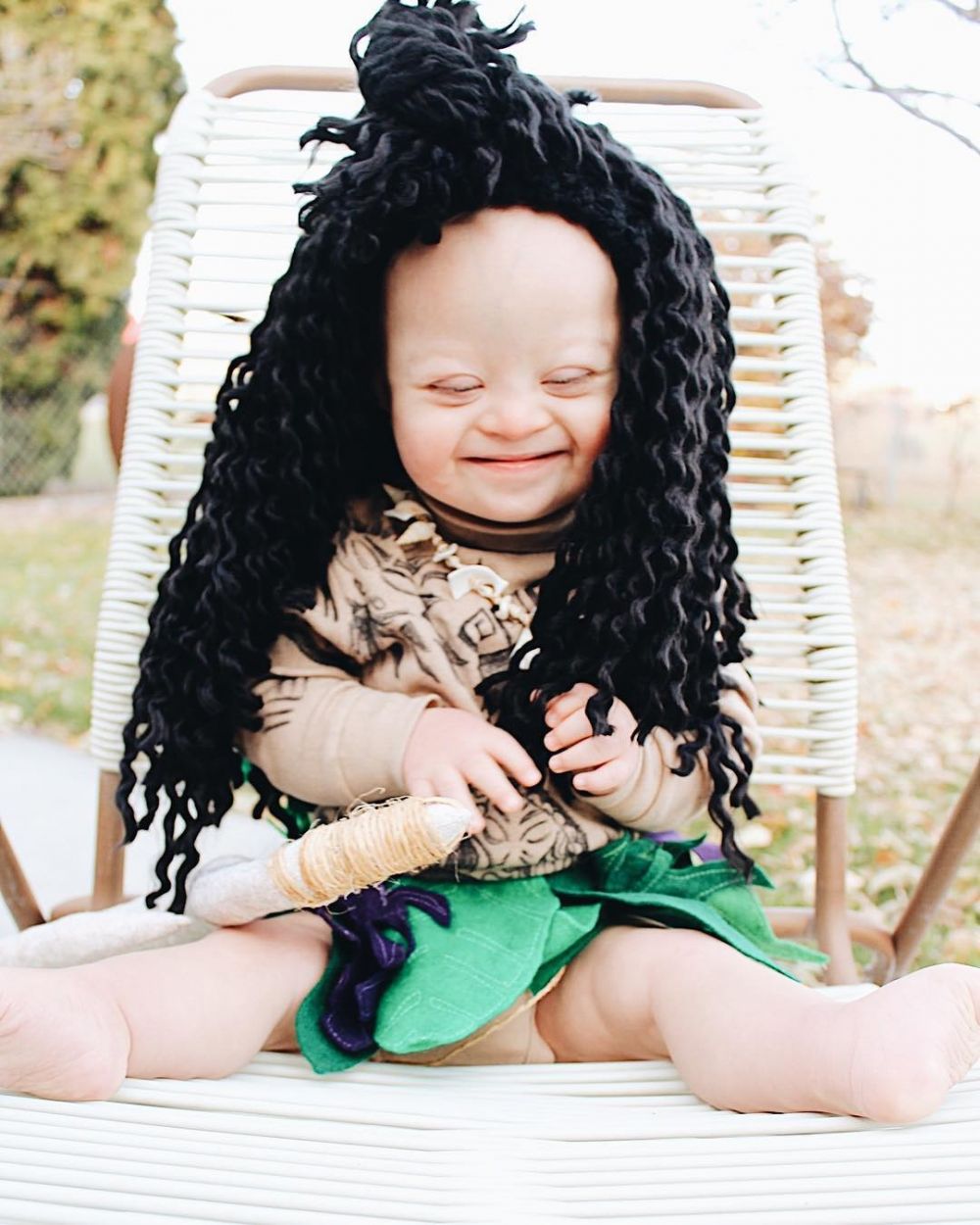 10 Potret Case, bayi penderita down syndrome yang ngegemesin banget