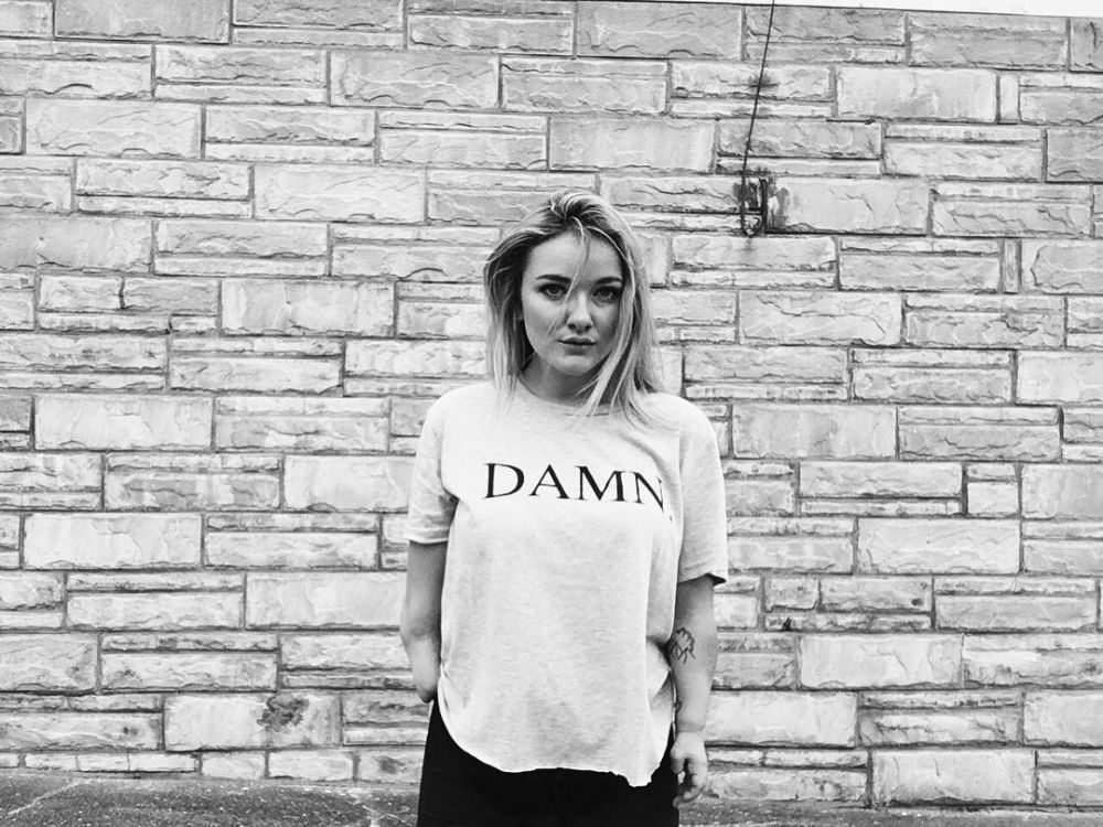 10 Potret Molly Higgins, selebgram cantik dengan tubuh tak sempurna