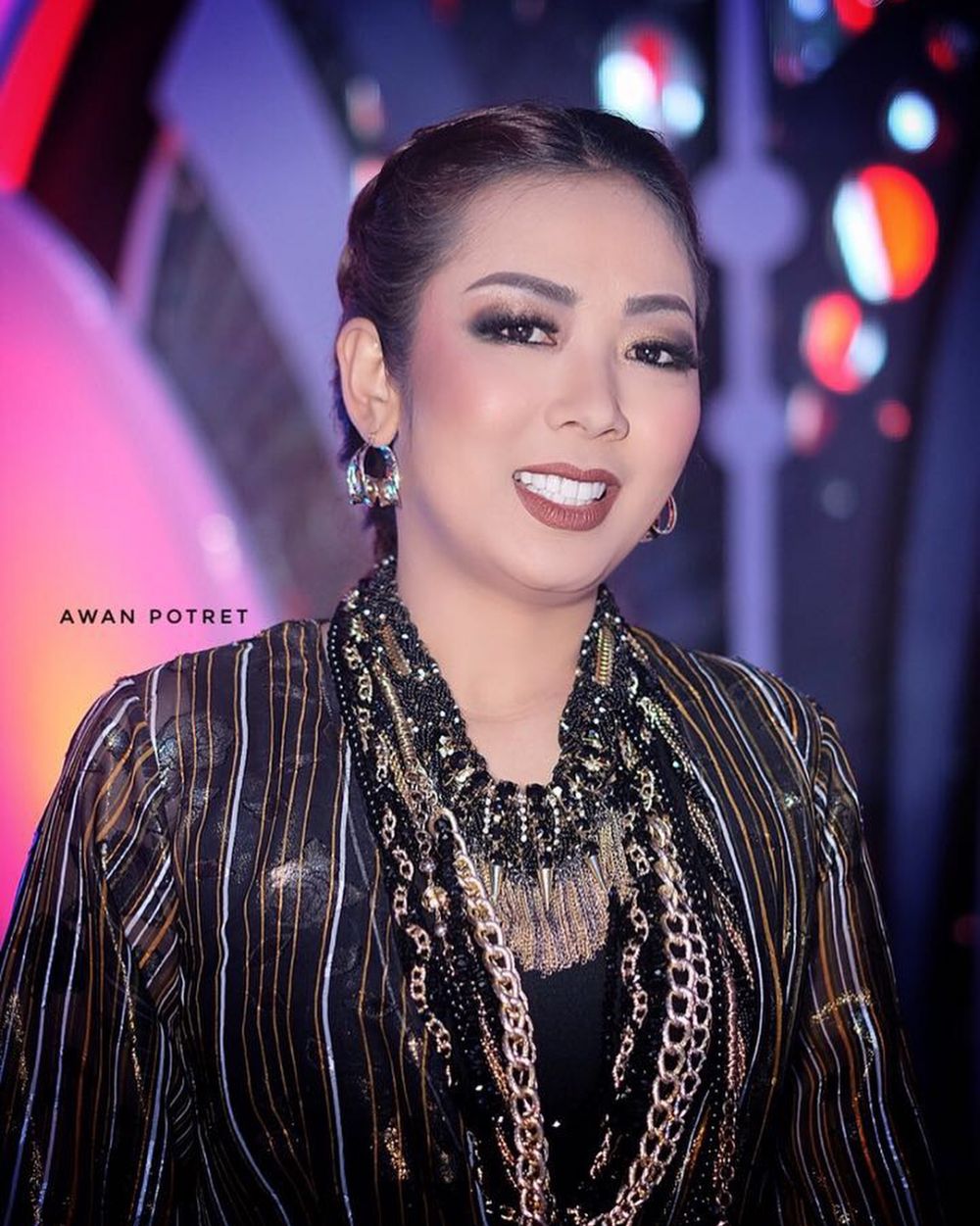 Demi gigi putih, 5 seleb cantik ini rela habiskan ratusan juta