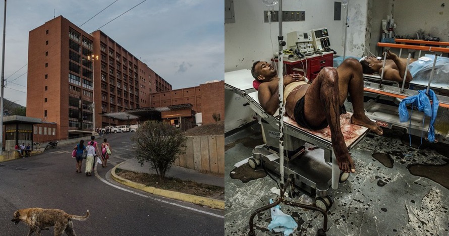 Kumuh dan tak steril, ini 8 potret rumah sakit terburuk di dunia
