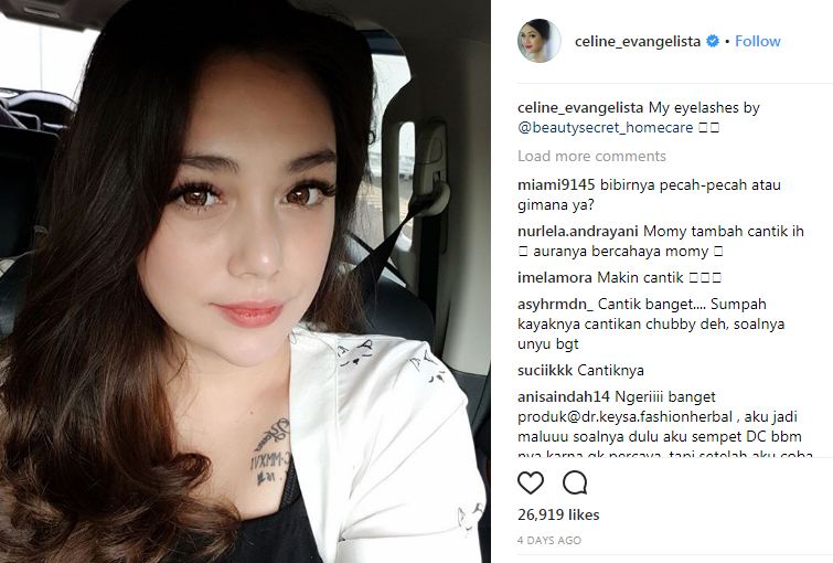 Pamer foto close up, bibir Celine Evangelista jadi sorotan warganet