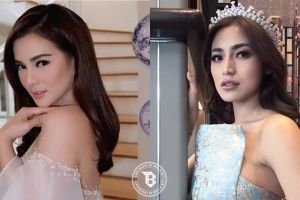 Gaya 10 selebriti yang diam-diam suka kerokan, obat masuk angin nih