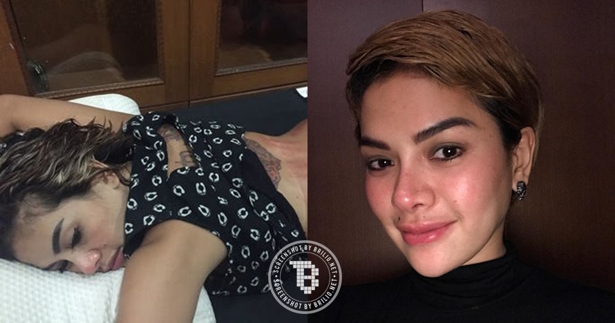 Gaya 10 selebriti yang diam-diam suka kerokan, obat masuk angin nih