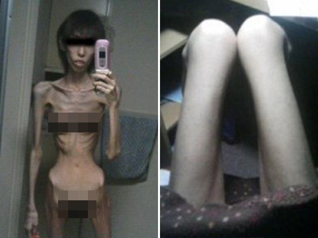 Tak diberi makan kakeknya, kondisi tubuh wanita ini memprihatinkan