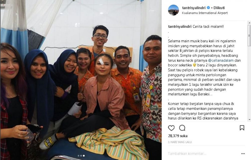 7 Penyanyi Tanah Air ini cedera saat manggung, ada yang patah tulang