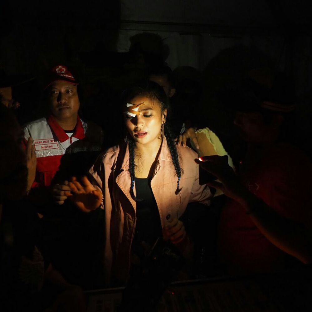 7 Penyanyi Tanah Air ini cedera saat manggung, ada yang patah tulang