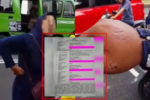 Emak-emak gigit polisi saat mau ditilang akhirnya dilaporkan