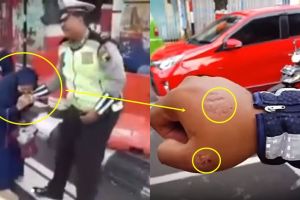 Ini pengakuan polisi yang digigit emak-emak ogah ditilang