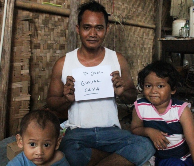 5 Kasus rencana jual organ tubuh yang pernah bikin heboh di Indonesia