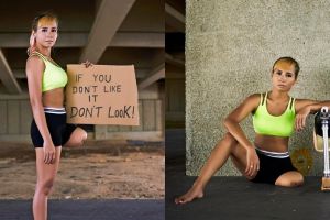 Relakan satu kakinya diamputasi, keinginan wanita ini malah terwujud