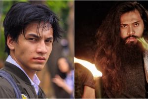 Punya image bad boy, 7 seleb ganteng ini ternyata takut jarum suntik