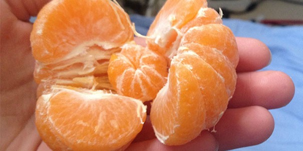 Sering disepelekan, ternyata ini 7 manfaat buah kersen bagi tubuh