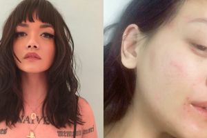 Curhatan model cantik Dylan Sada, alami pelecehan hingga babak belur