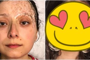 Transformasi makeup 8 orang miliki kekurangan di wajah ini bikin kagum
