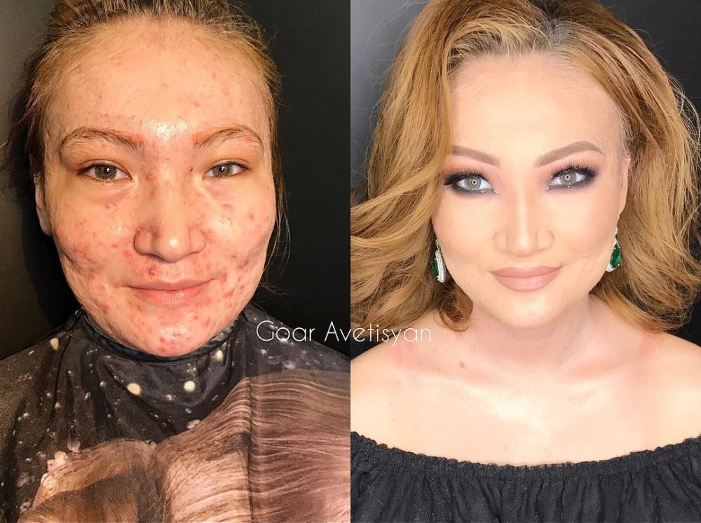 Transformasi makeup 8 orang miliki kekurangan di wajah ini bikin kagum