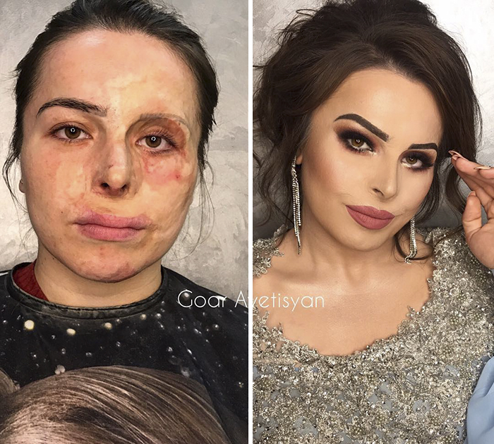 Transformasi makeup 8 orang miliki kekurangan di wajah ini bikin kagum