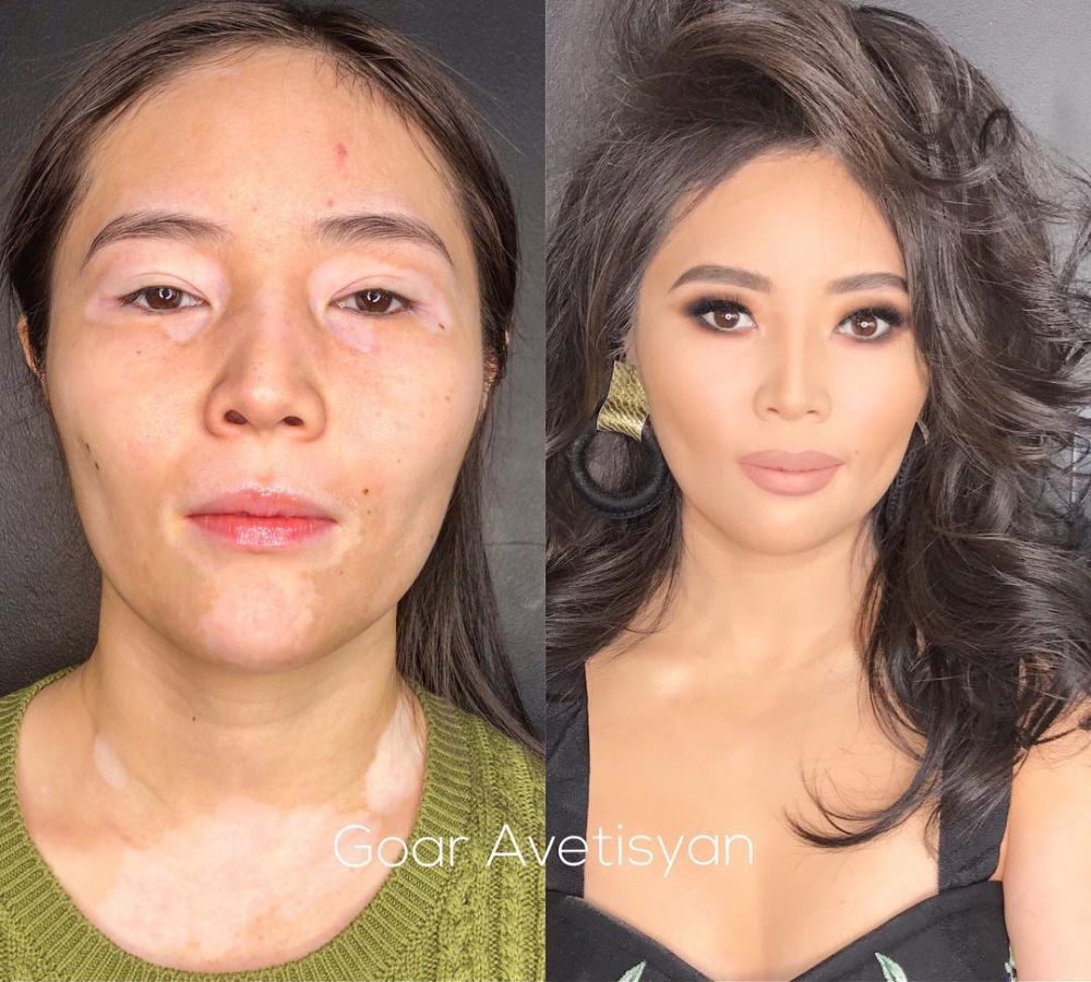 Transformasi makeup 8 orang miliki kekurangan di wajah ini bikin kagum