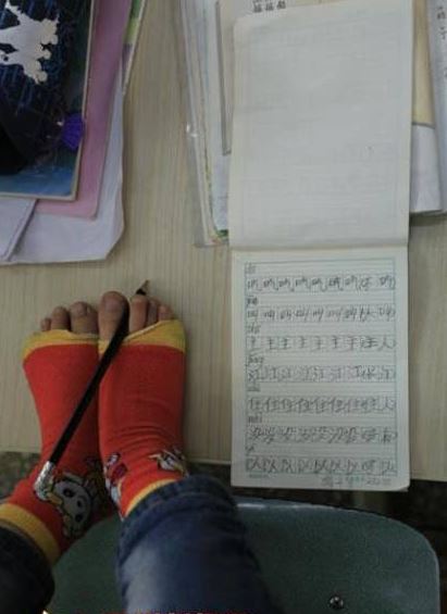 Kisah hidup bocah tunadaksa pakai kaki untuk menulis ini mengharukan