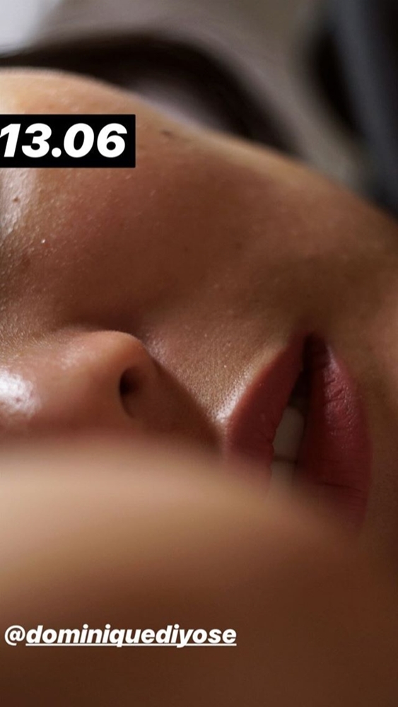 Detik-detik haru Dominique Diyose jalani persalinan, ini 10 fotonya