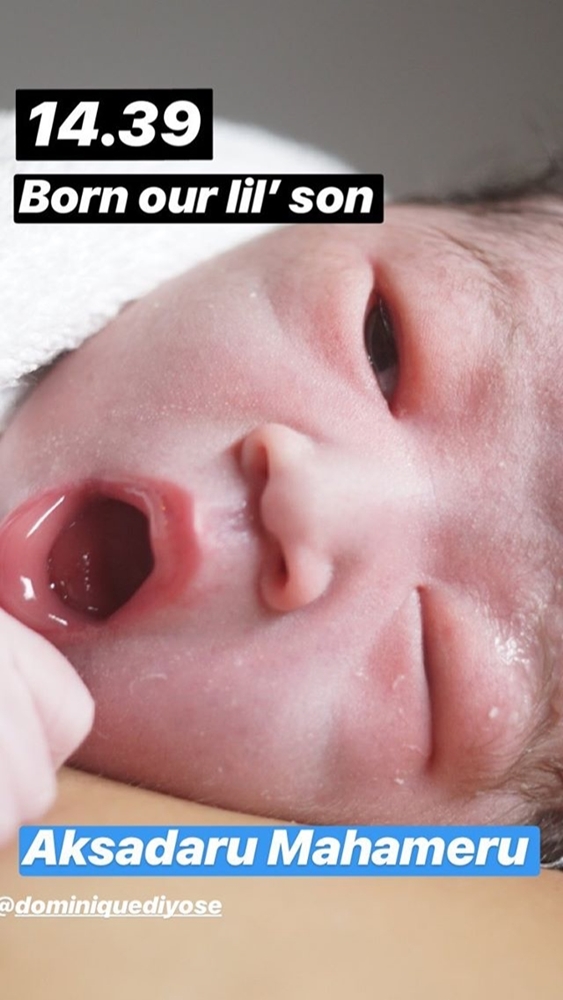 Detik-detik haru Dominique Diyose jalani persalinan, ini 10 fotonya