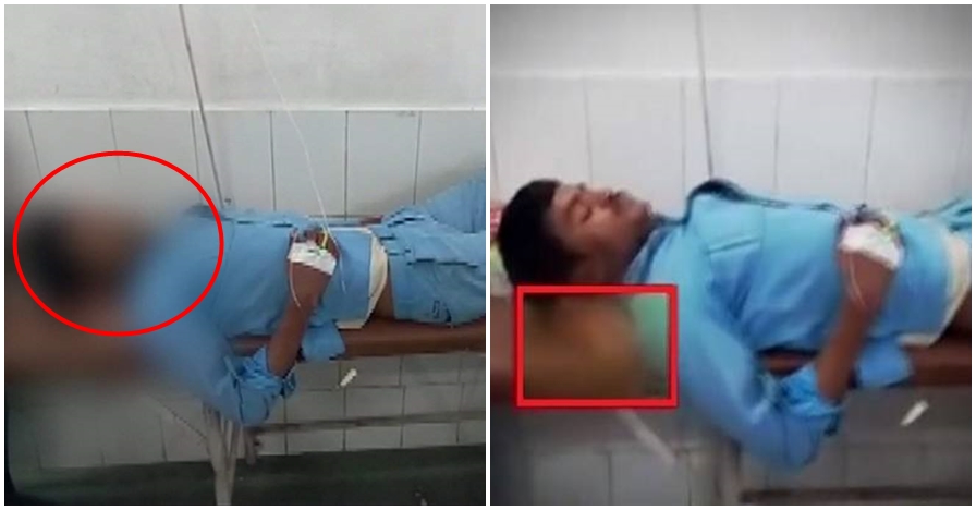 Perawat rumah sakit ini pakai potongan kaki pasien buat bantal tidur