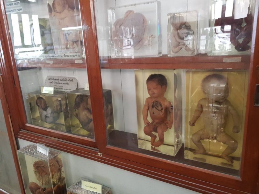 Koleksi ratusan mayat, 7 potret museum ini bikin pengunjung merinding