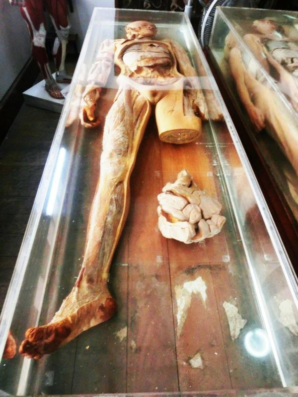 Koleksi ratusan mayat, 7 potret museum ini bikin pengunjung merinding