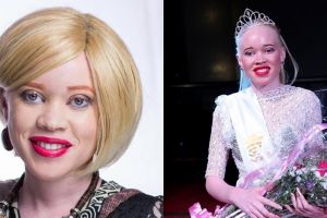7 Pesona cantiknya Sithembiso Mutukura, Miss Albino asal Zimbabwe