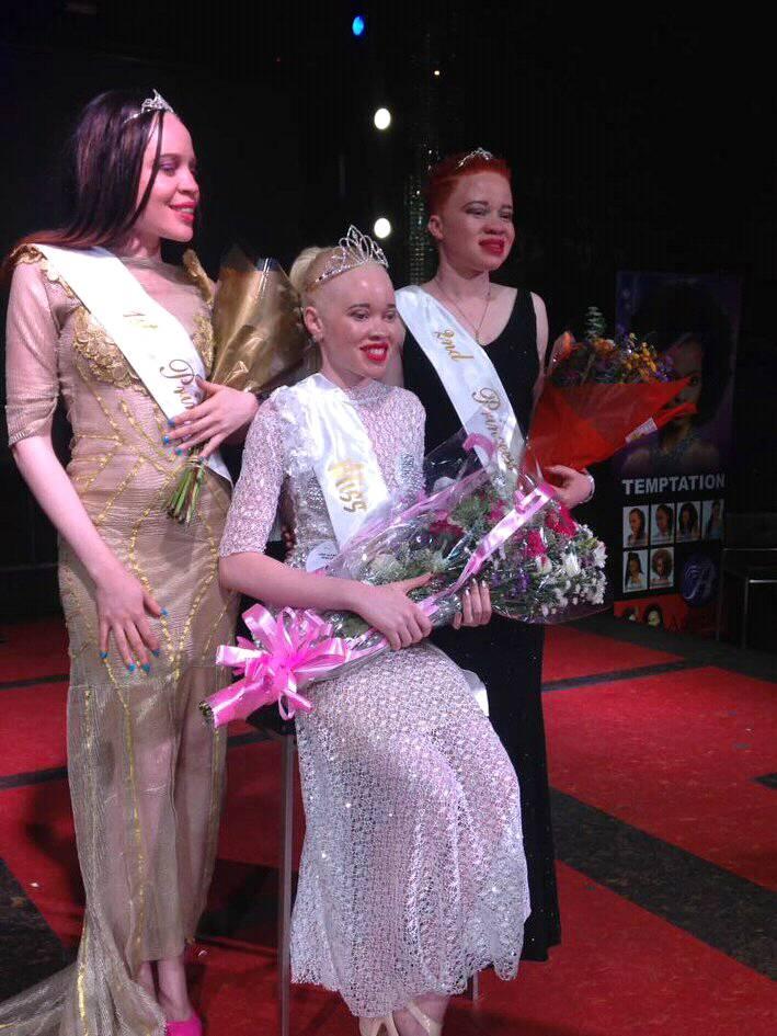7 Pesona cantiknya Sithembiso Mutukura, Miss Albino asal Zimbabwe
