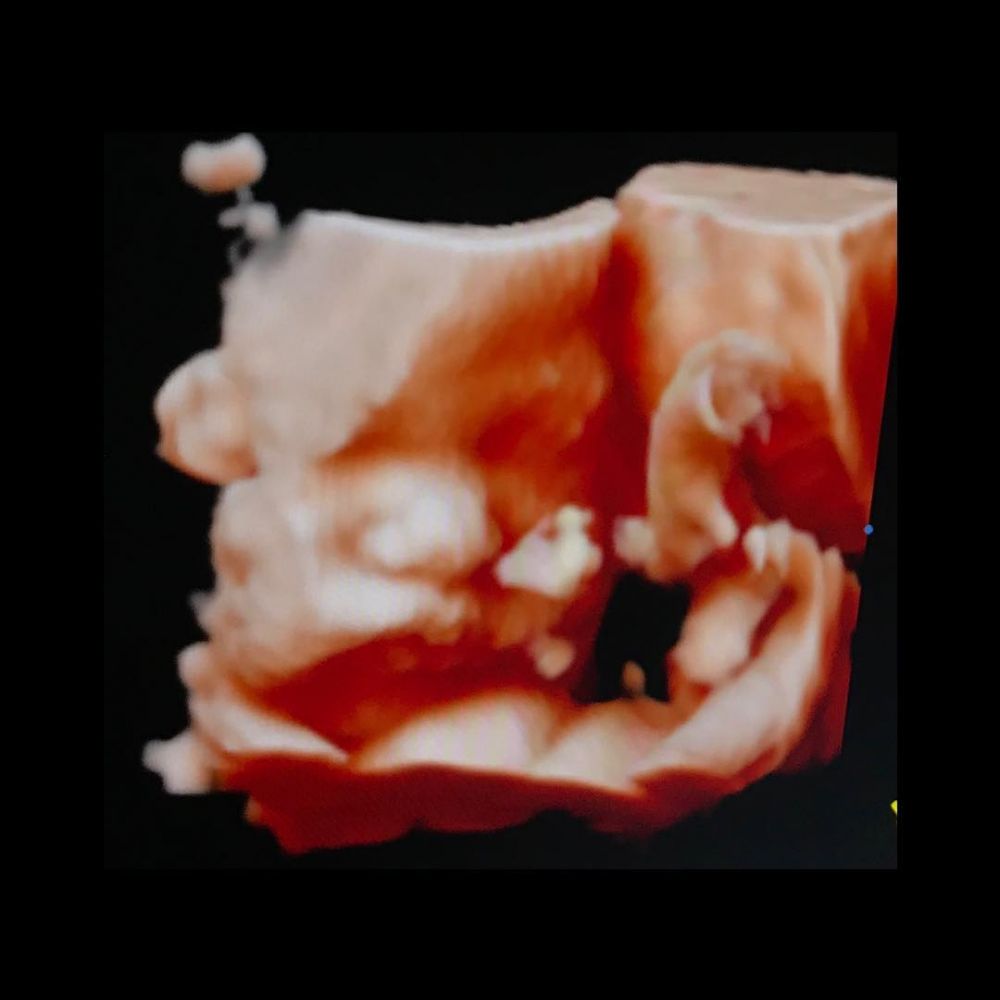 8 Momen baby shower Franda, tampak seru dan membahagiakan