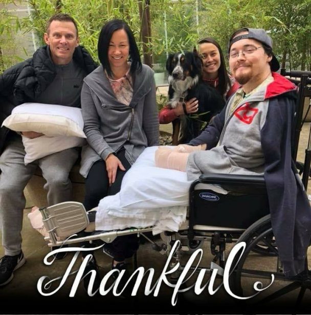 Cemburu berat, wanita ini potong tangan pacarnya pakai pedang samurai