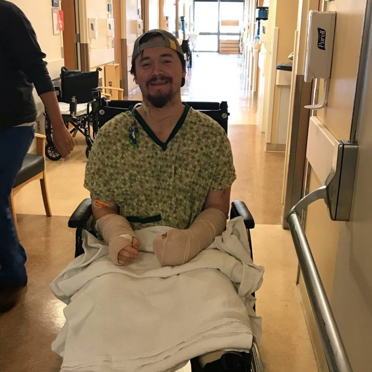 Cemburu berat, wanita ini potong tangan pacarnya pakai pedang samurai