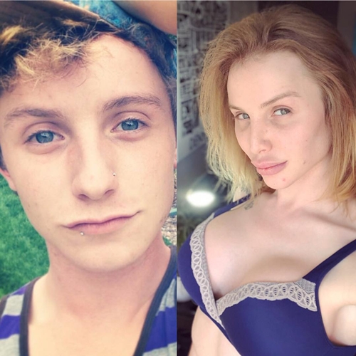 Kyleigh Potts, transgender habiskan Rp 1 M demi mirip Kylie Jenner