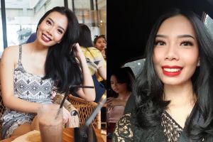 Jadi pusat perhatian, ini 10 pesona dokter cantik yang rawat Limbad