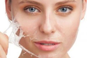 Ini alasan pemilik kulit berminyak wajib pakai pelembap yang tepat