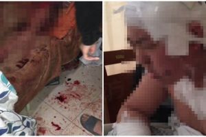 Diprotes sering kentut dan ngorok, pemuda ini nekat tikam dua temannya