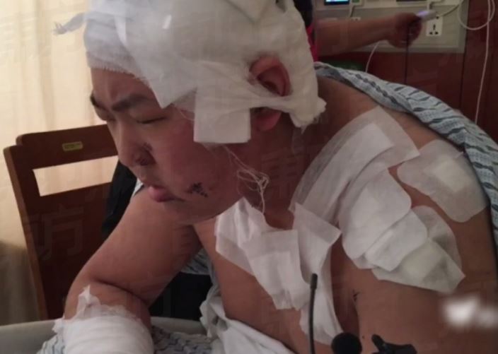 Diprotes sering kentut dan ngorok, pemuda ini nekat tikam dua temannya