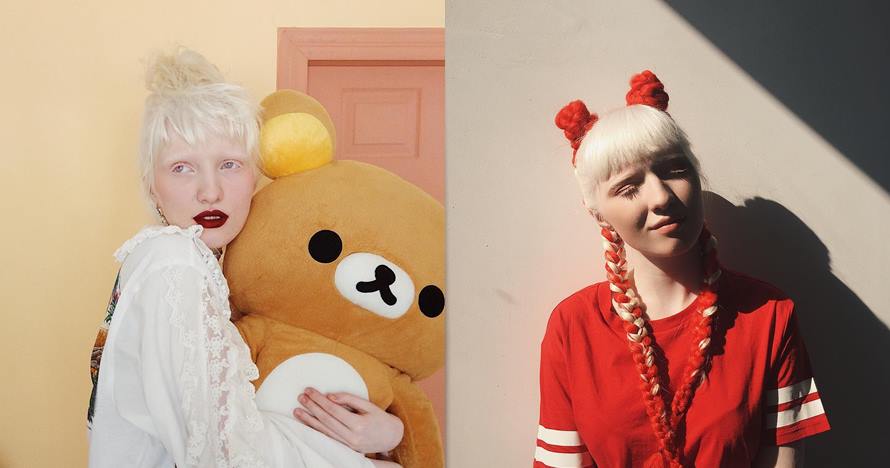 10 Pesona Nastya Zhidkova, model albino yang bermata indah