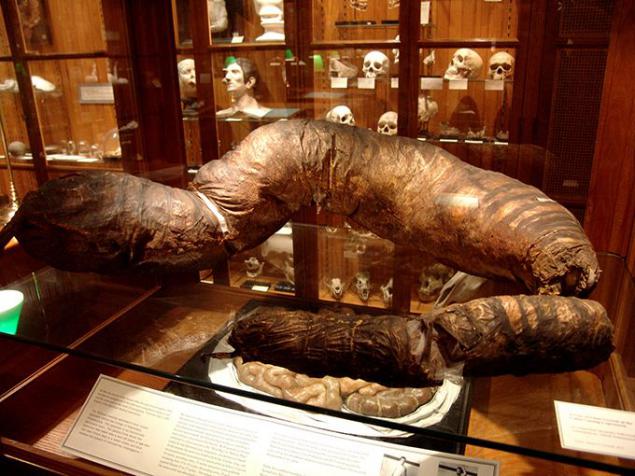 4 Koleksi mengagetkan di Museum Mutter, salah satunya otak Einstein