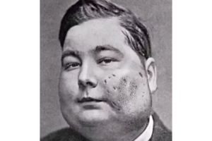 4 Potret mengerikan efek radium yang jadi bahan kecantikan zaman dulu