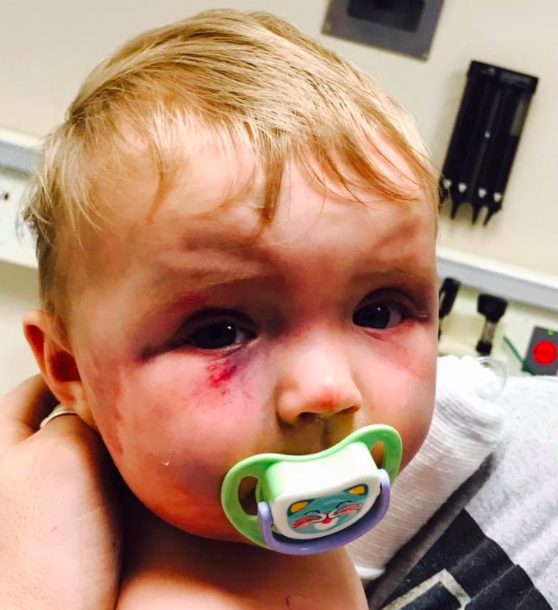 Suaminya idap kanker, ibu ini lampiaskan emosi dengan siksa bayinya