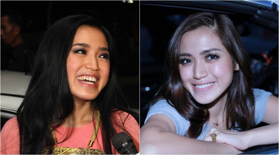 11 Penampilan seleb sebelum dan sesudah veneer gigi, senyumnya beda