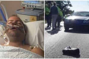 Kecelakaan lalu lintas paling parah, bikin 47 tulang pria ini patah