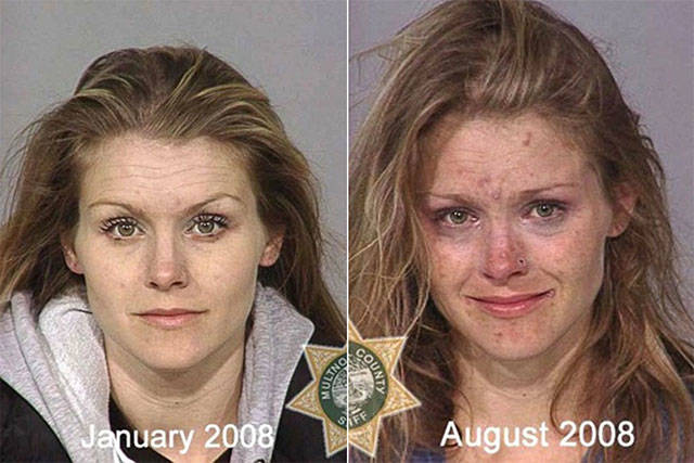 Ngeri, begini transformasi wajah 10 orang setelah pakai narkoba