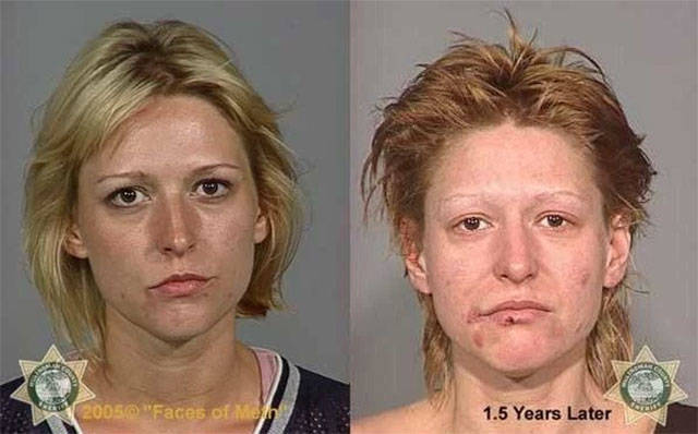 Ngeri, begini transformasi wajah 10 orang setelah pakai narkoba