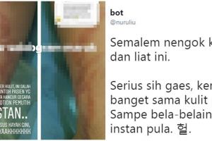 Kisah ngeri wanita kulitnya rusak usai pakai lotion pemutih