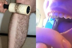 Dijamin nggak tenang melihat 10 foto ini, bikin ngilu banget