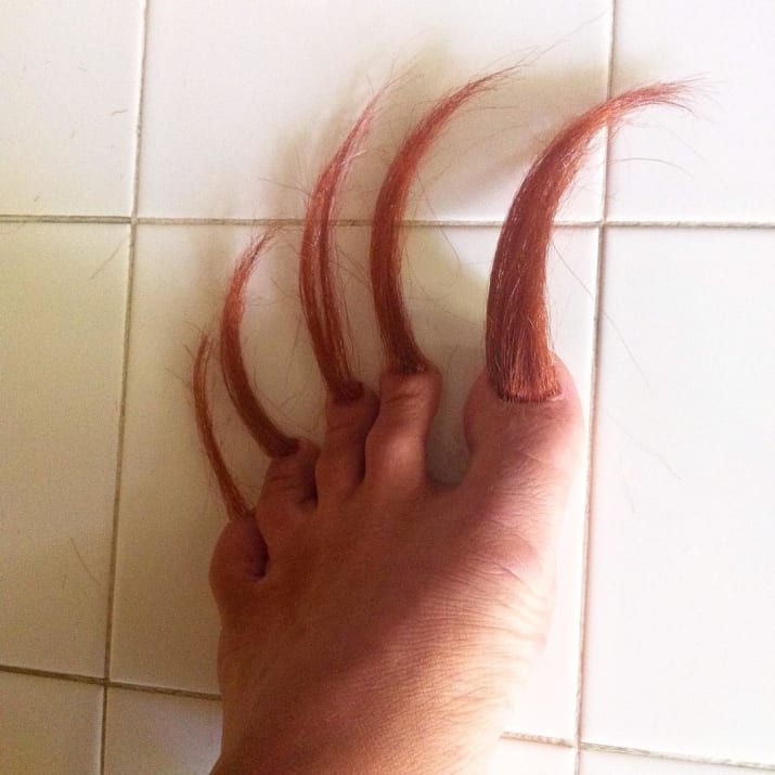 Dijamin nggak tenang melihat 10 foto ini, bikin ngilu banget