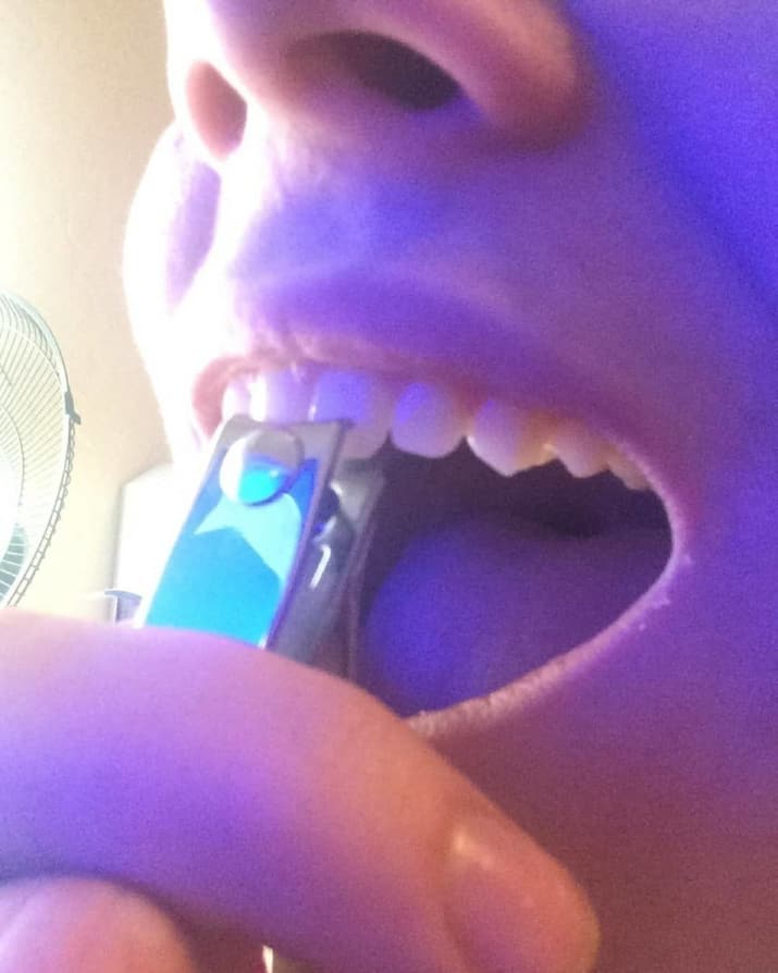 Dijamin nggak tenang melihat 10 foto ini, bikin ngilu banget