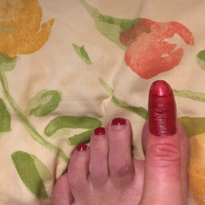 Dijamin nggak tenang melihat 10 foto ini, bikin ngilu banget